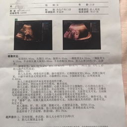 安卓攻略系统b超,轻松掌握B超操作与解读
